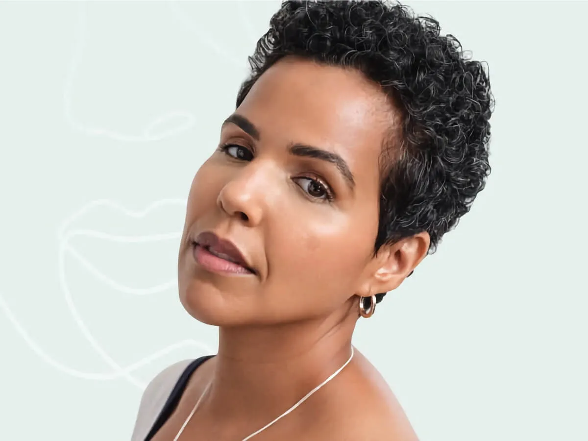 Radiesse relleno facial en Juriquilla, Querétaro para restaurar volumen facial