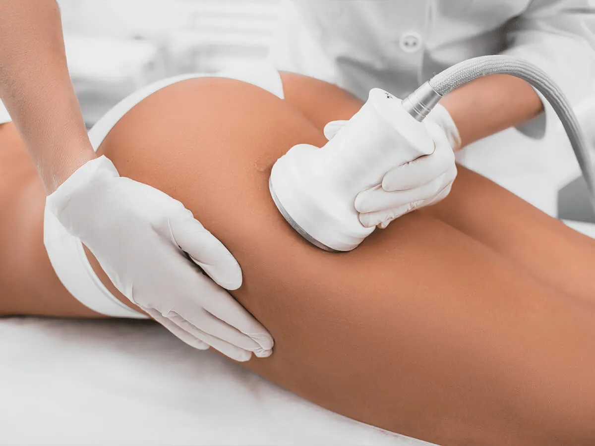 Tratamiento de radiofrecuencia Venus Legacy en Juriquilla, Querétaro para rejuvenecimiento facial